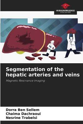 [预订]Segmentation of the hepatic arteries and veins 9786205875988