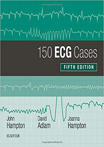 预订  150 ECG Cases 心电图150例 书籍/杂志/报纸 原版其它 原图主图