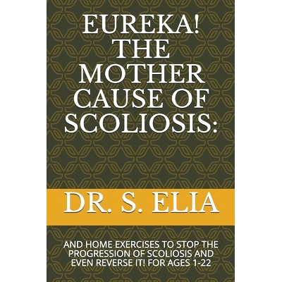 预订 Eureka! the Mother Cause of Scoliosis: And Home Exercises to S* the Progression of Scoliosis and Even Reverse It!