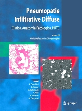 预订 Pneumopatie Infiltrative Diffuse: Clinica, Anatomia Patologica, HRTC: 9788847002746