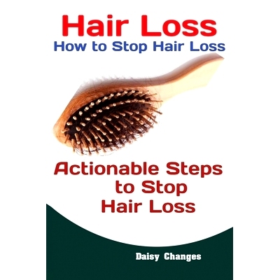预订 Hair Loss: How to S* Hair Loss Actionable Steps to S* Hair Loss (Hair Loss Cure, Hair Care, Natural Hair Loss C