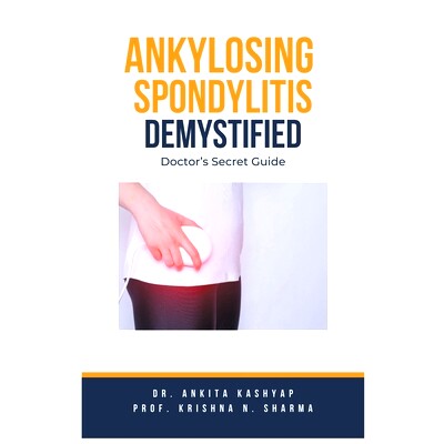 预订 Ankylosing Spondylitis Demystified: Doctor's Secret Guide