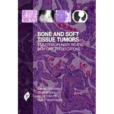 预订 Bone and Soft Tissue Tumors: A Multidisciplinary Review with Case Presentations: 9781907816222