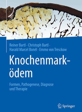 预订 Knochenmarködem