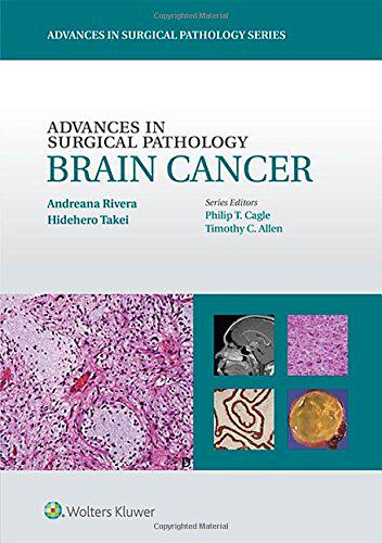 【预订】Advances in Surgical Pathology