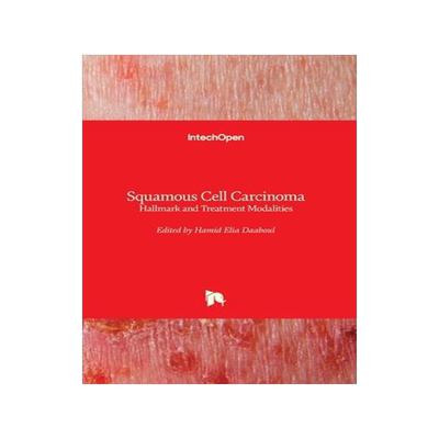 [预订]Squamous Cell Carcinoma - Hallmark and Treatment Modalities 9781789843231