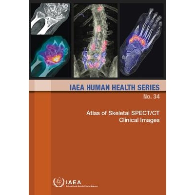 预订 Atlas of Skeletal SPECT/CT Clinical Images 骨骼 SPECT/CT 临床图像图集（丛书）: 9789201034168