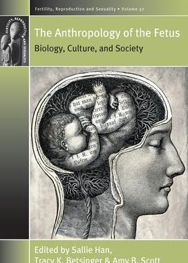 [预订]ANTHROPOLOGY OF THE FETUS 9781785336911