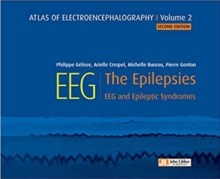 【预订】Atlas of electroencephalography:The Epilepsies. EEG and epileptic syndromes (JOHN LIBBEY) 9782742015917