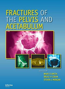 【预订】Fractures of the Pelvis and Acetabulum