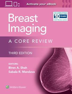 Imaging Breast 9781975195687 预订