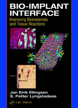 【预订】Bio-Implant Interface