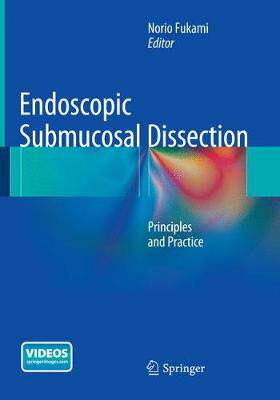 【预订】Endoscopic Submucosal Dissection