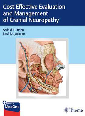 [预订]Cost-Effective Evaluation and Management of Cranial Neuropathy 9781684200191