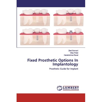 预订 Fixed Prosthetic Options In Implantology: 9786202530118