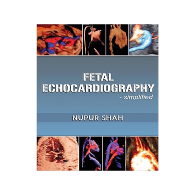 [预订]Fetal Echocardiography - Simplified 9781636408484