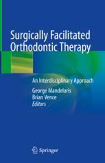 【预订】Surgically Facilitated Orthodontic Therapy 9783030900984