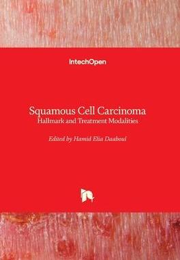 [预订]Squamous Cell Carcinoma - Hallmark and Treatment Modalities 9781789843231