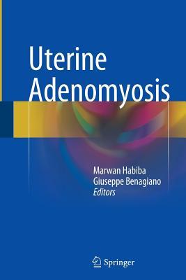 【预订】Uterine Adenomyosis