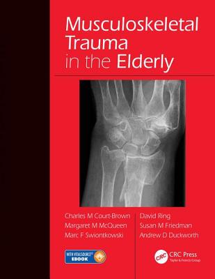 【预订】Musculoskeletal Trauma in the Elderly