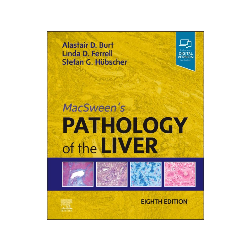 现货Macsween’s Pathology of the Liver