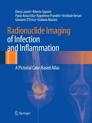 【预订】Radionuclide Imaging of Infection and Inflammation