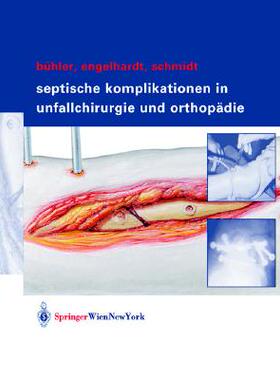 预订 Septische postoperative Komplikationen