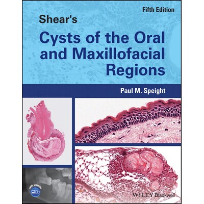 预订 Shear’S Cysts Of The Oral And Maxillofacial Regions 5Th Edition 口腔颌面部切氏囊肿 第5版 9781119354994