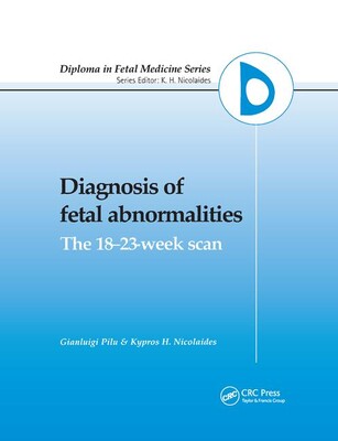 【预订】diagnosis of fetal abnormalities: the 18-23-week scan