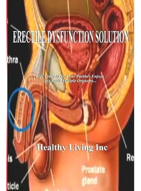 预订 Erectile Dysfunction Solution: 9781077797994