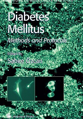 【预订】Diabetes Mellitus