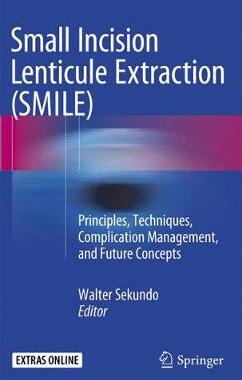 预订 Small Incision Lenticule Extraction (SMILE)