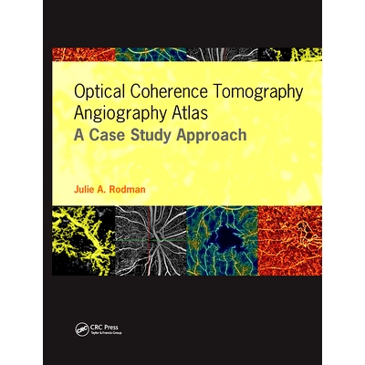 预订 Optical Coherence Tomography Angiography Atlas: A Case Study Approach 光学相干断层扫描血管造影图集: 9781630916411
