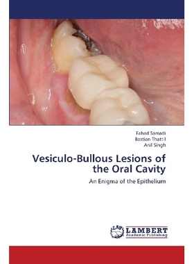 预订 Vesiculo-Bullous Lesions of the Oral Cavity: 9783659370502