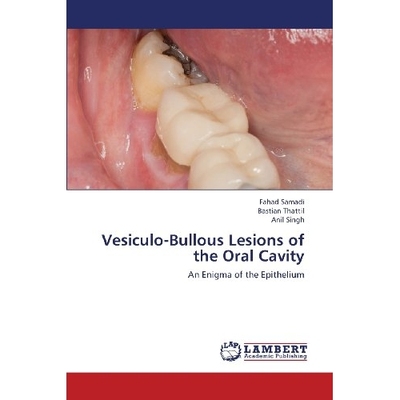 预订 Vesiculo-Bullous Lesions of the Oral Cavity: 9783659370502