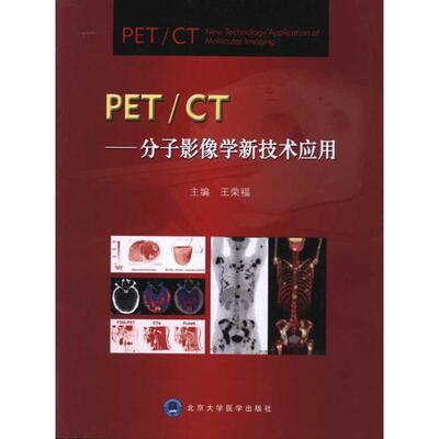PET/CT:分子影像学新技术应用  9787565901997