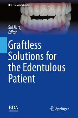 【预订】Graftless Solutions for the Edentulous Patient