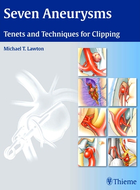 预订 Seven Aneurysms: Tenets and Techniques for Clipping 七动脉瘤: 9781604060546