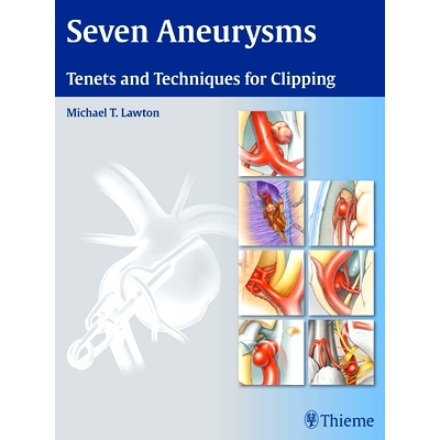 预订 Seven Aneurysms: Tenets and Techniques for Clipping 七动脉瘤: 9781604060546
