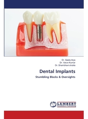 预订 Dental Implants 牙科植入物: 9786202803212