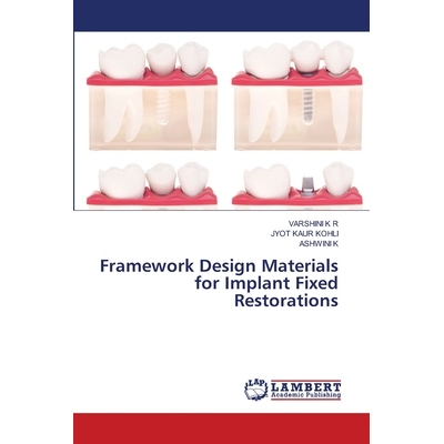 预订 Framework Design Materials for Implant Fixed Restorations: 9786208456207