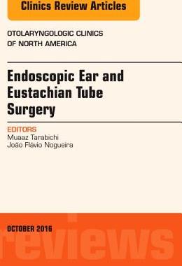 【预订】Endoscopic Ear and Eustachian Tube Surgery, An Issue of Otolaryngologic Clinics of North America