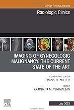 [预订]Imaging of Gynecologic Malignancy 9780323940351