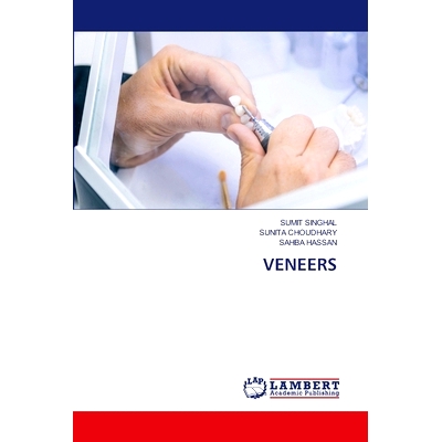 预订 Veneers: 9783659393365