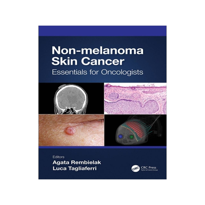[预订]Non-melanoma Skin Cancer