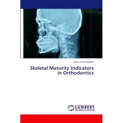 预订 Skeletal Maturity Indicators in Orthodontics 正畸中的骨骼成熟度指标: 9786208065348