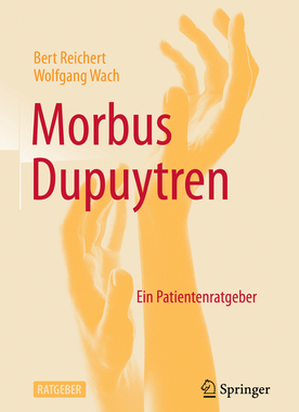 预订 Morbus Dupuytren