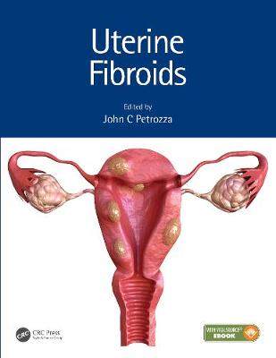 【预订】Uterine Fibroids