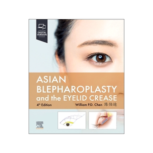 预订 Asian Blepharoplasty and the Eyelid Crease