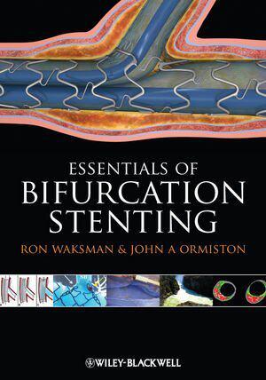 【预订】Bifurcation Stenting